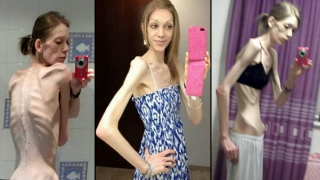 This Former Anorexic Girl Just Won A Bodybuilding Competition