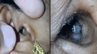 WATCH: The Cheeky Moment A Spider Crawls Out Of A Woman’s Ear