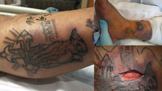 Man Dies After Going For Swim With A Fresh Tattoo