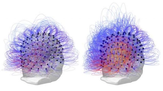 Researchers Restore Consciousness In Man After 15 Years In Vegetative State