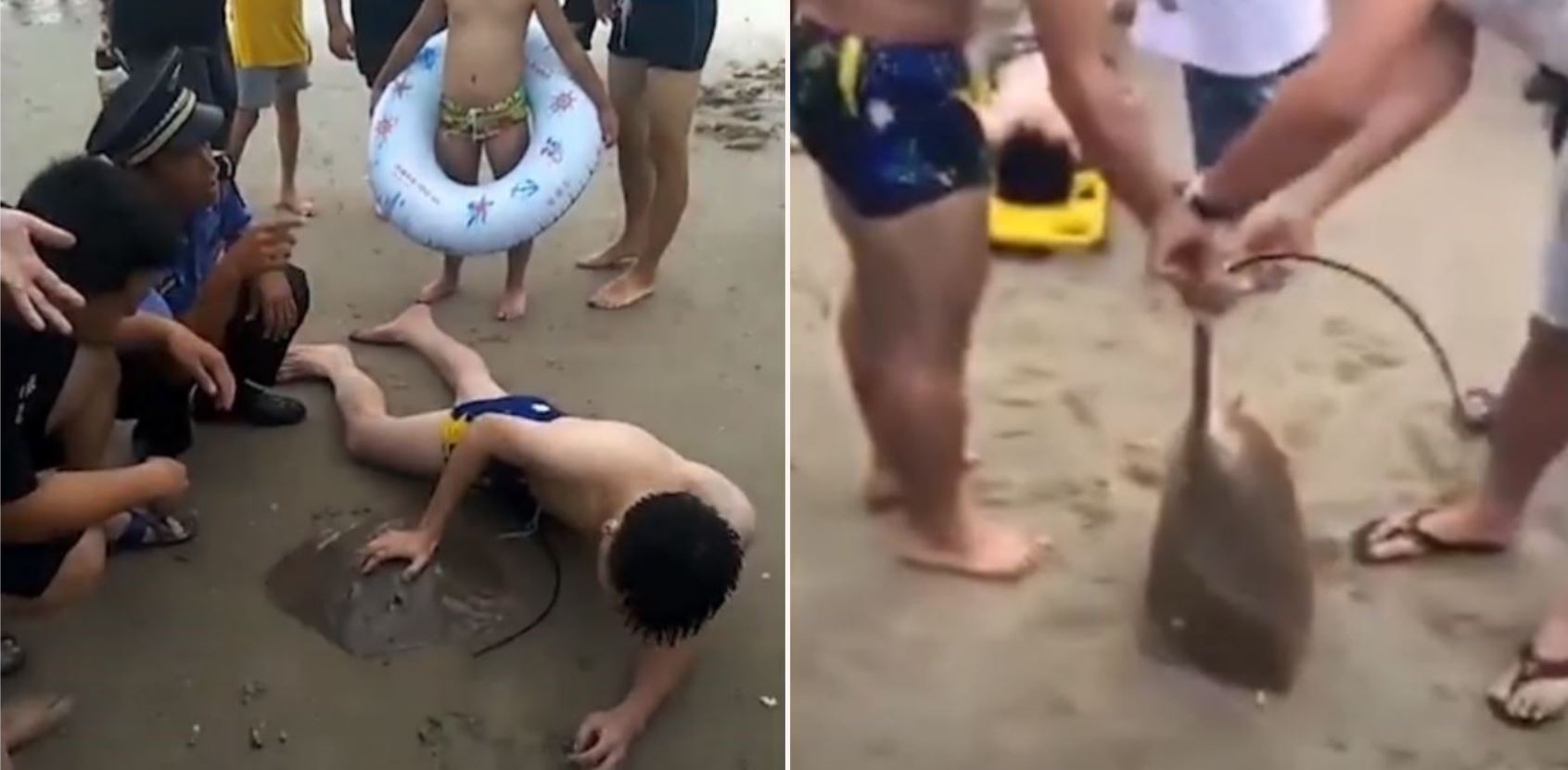 Poor bloke gets stung on the dick by stingray