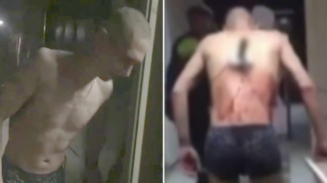 Shirtless Russian bloke with knife in back leaves hospital for a durry in the freezing