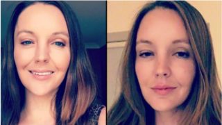 Sheila who lost her forehead has a warning for others!