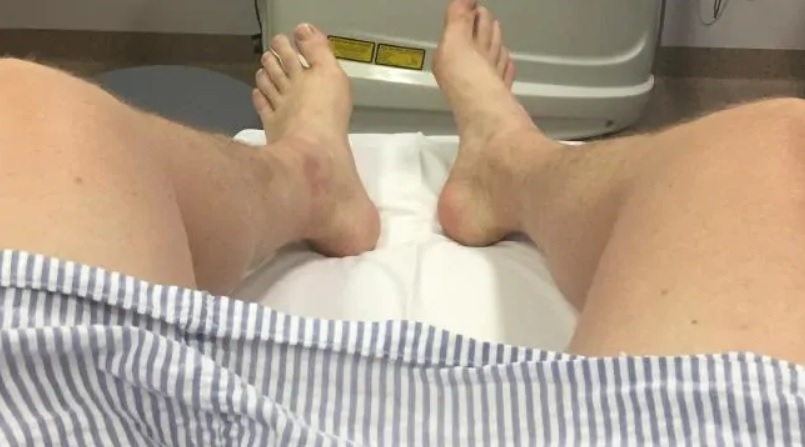 Bloke gets $1000 of Botox injected into his scrotum to impress chicks