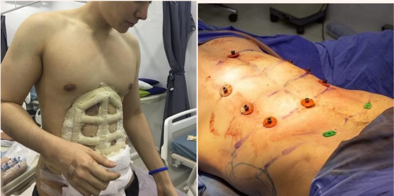 This Hospital is offering instant six-pack surgery and it’s pretty f**ken weird