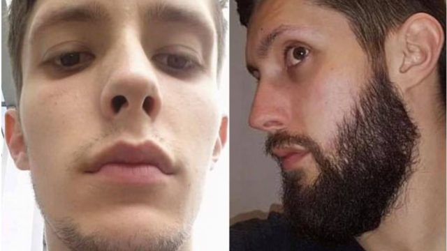 Blokes desperate to grow beards claim to have found a remedy for patchy face hair!