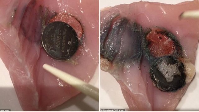 Battery experiment proves how f**ked your insides are if swallowed