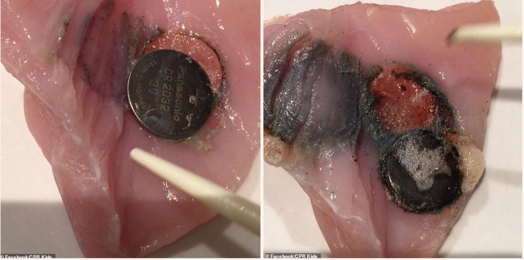 Battery experiment proves how f**ked your insides are if swallowed
