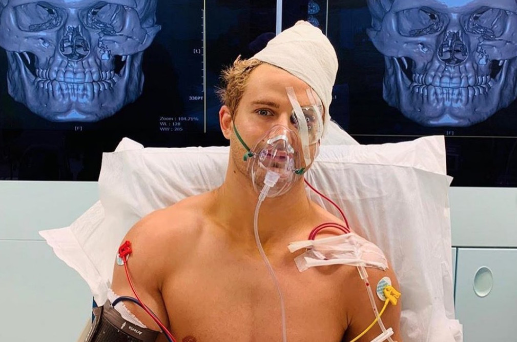 MMA Fighter who was knocked out cold has shared his horrific post-fight x-ray