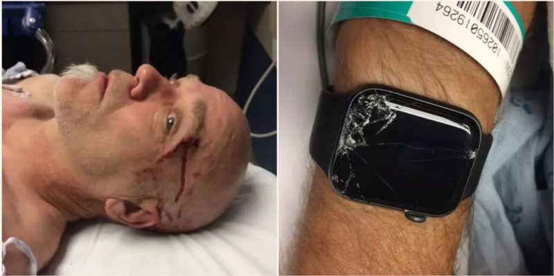 Bloke left unconscious and alone in the woods until Apple Watch saved his life