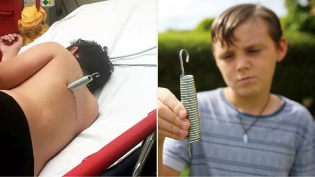 Kid gets speared by metal spring during trampoline accident