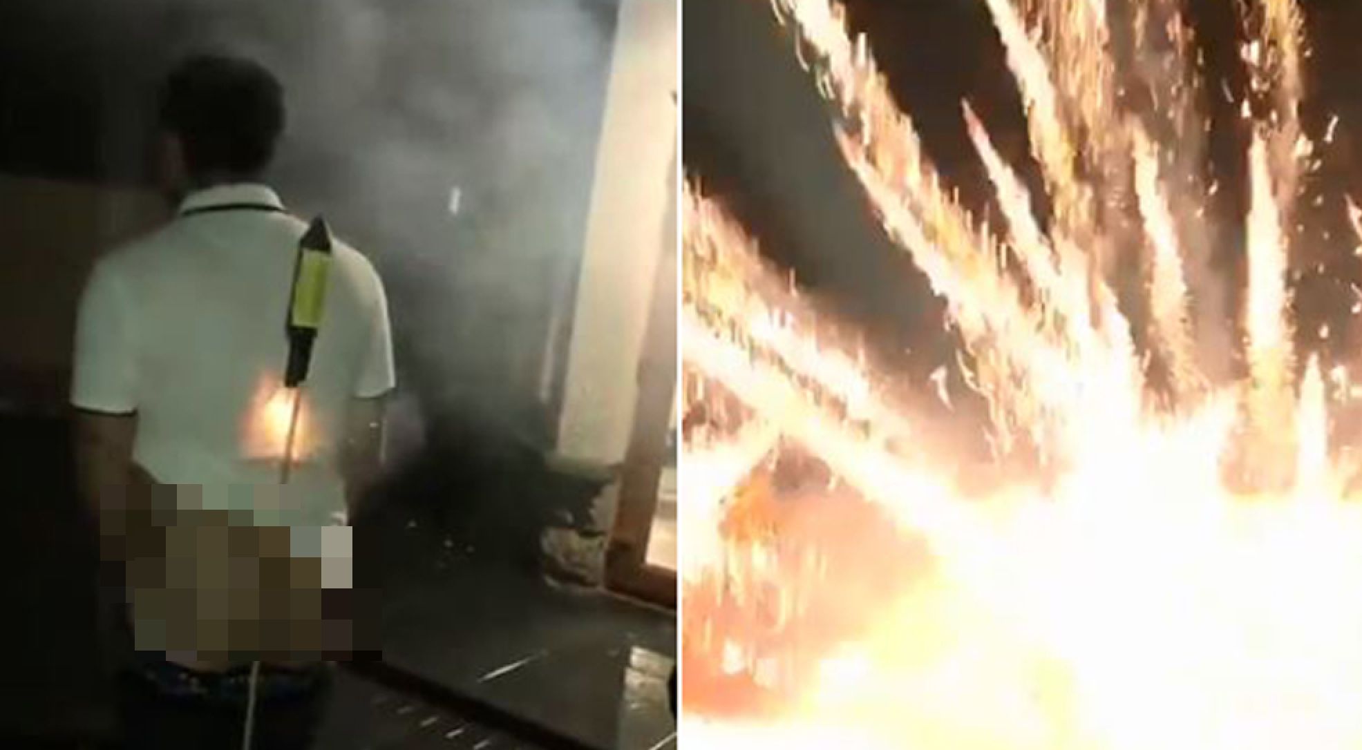 Bloke tries to shoot fireworks from his bum cheeks; regrets it