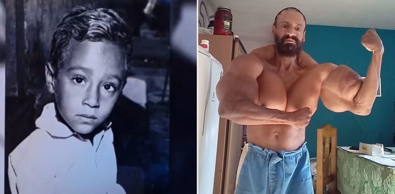 Once nicknamed ‘skinny dog’ this guy abused synthol more than anyone in history