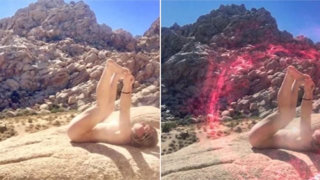 Doctor’s issue a warning against this new ‘bum-sunning’ craze
