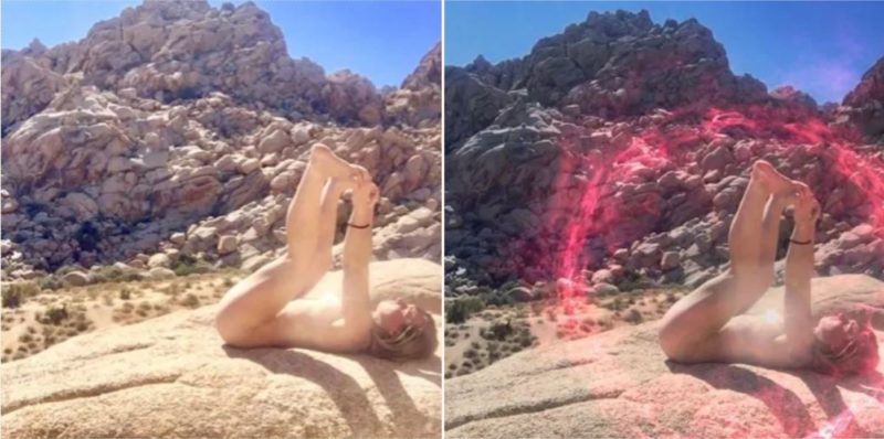 Doctors have warned against new ritual of ‘bum-sunning’