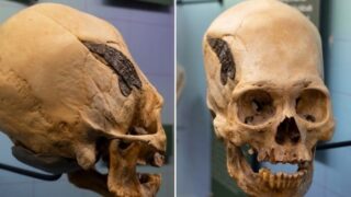 2,000 year old skull provides evidence ancient cultures used advanced surgery