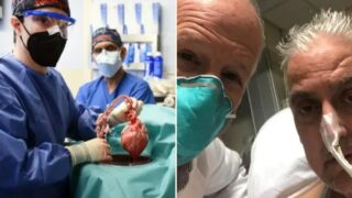 US bloke receives first pig-human heart transplant